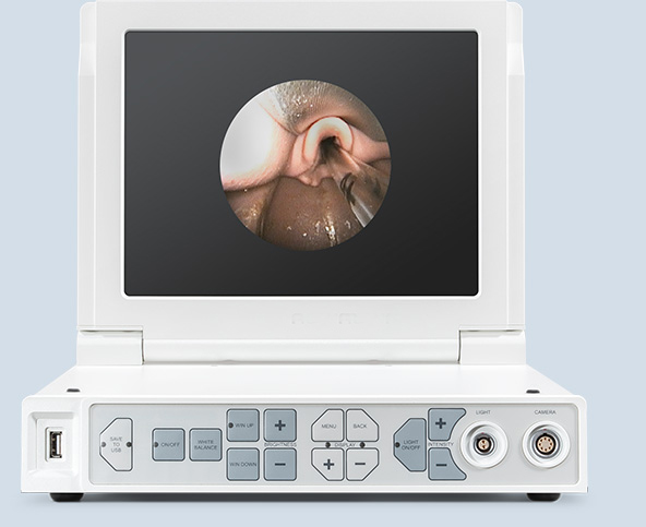 Video Laryngoskop